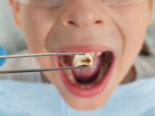 Best Emergency Gum Pain Relief  in White Oak, PA